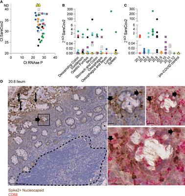 Disrupted Peyer’s Patch Microanatomy in COVID-19 Including Germinal Centre Atrophy Independent of Local Virus